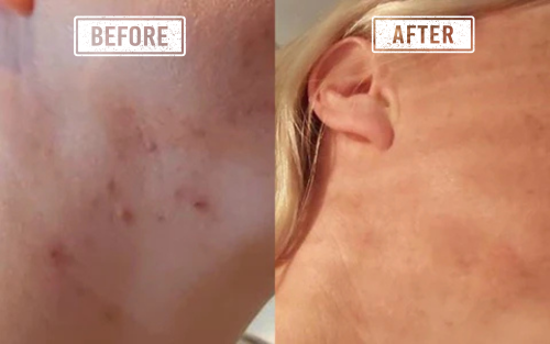 AquaClear: Restore Your Hair's Luster & Your Skin's Glow.
