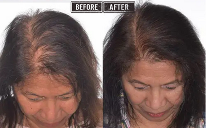 AquaClear: Restore Your Hair's Luster & Your Skin's Glow.